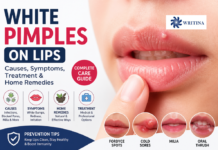 White Pimple on Lip: Everything You Need to Know About Causes, Natural Remedies, and Professional Care White Pimple on Lip
