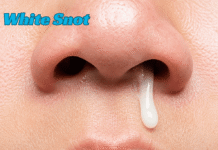 White Snot: Complete Guide to Causes, Meaning, Symptoms, Treatments, Home Remedies, Prevention Tips, When to Seek Medical Help, and Sinus Health White Snot