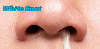 White Snot: Complete Guide to Causes, Meaning, Symptoms, Treatments, Home Remedies, Prevention Tips, When to Seek Medical Help, and Sinus Health White Snot