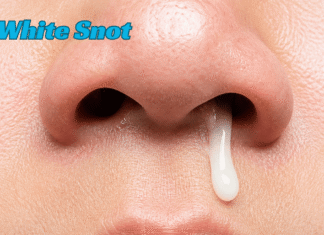 White Snot: Complete Guide to Causes, Meaning, Symptoms, Treatments, Home Remedies, Prevention Tips, When to Seek Medical Help, and Sinus Health White Snot