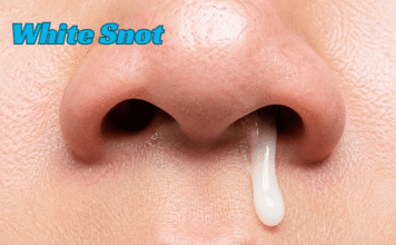 White Snot: Complete Guide to Causes, Meaning, Symptoms, Treatments, Home Remedies, Prevention Tips, When to Seek Medical Help, and Sinus Health White Snot