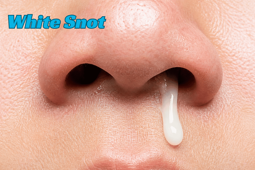 White Snot White Snot
